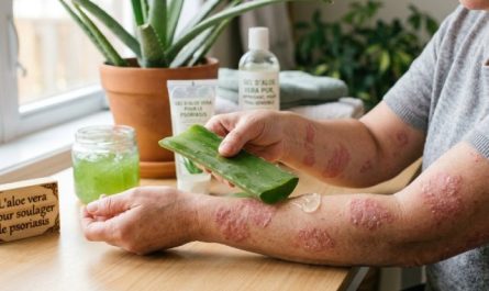aloe vera